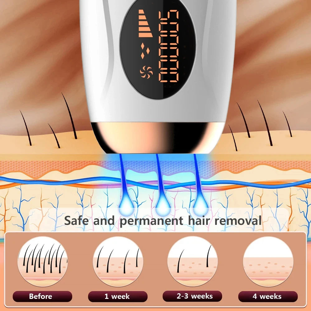 Épilateur à Lumière Pulsée IPL